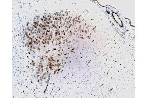 Staining of the neurons and endothelial cells of the blood vessels, formalin-fixed, citrate buffer pre-treatment, 10X
