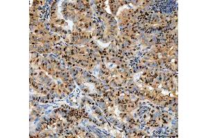IHC analysis of PCNA using anti-PCNA antibody (ABIN7599179).