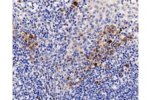 Immunohistochemistry analysis of paraffin-embedded human tonsil using CASP1 Polyclonal Antibody at dilution of 1:300. (Caspase 1 anticorps)