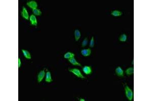 Immunofluorescent analysis of Hela cells using ABIN7159407 at dilution of 1: 100 and Alexa Fluor 488-congugated AffiniPure Goat Anti-Rabbit IgG(H+L) (Menin anticorps  (AA 1-615))