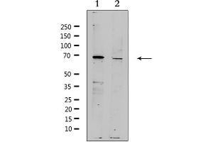 Western blot analysis of extracts from various samples, using ZP4 Antibody. (ZP4 anticorps  (Internal Region))