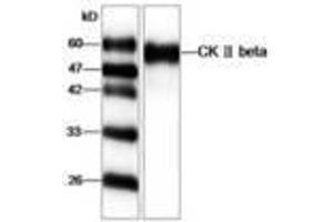 Image no. 1 for anti-Casein Kinase 2, beta (CSNK2B) antibody (ABIN791461) (CSNK2B anticorps)