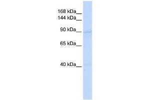 WB Suggested Anti-RAD54B Antibody Titration:  0. (RAD54B anticorps  (Middle Region))
