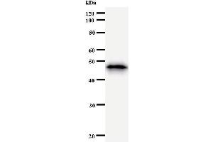 Western Blotting (WB) image for anti-SMAD, Mothers Against DPP Homolog 1 (SMAD1) antibody (ABIN933125)