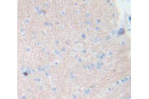 Used in DAB staining on fromalin fixed paraffin- embedded Kidney tissue (Tachykinin 3 anticorps  (AA 29-102))