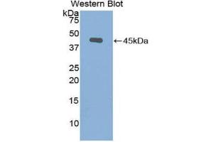 Western Blotting (WB) image for anti-Gelsolin (GSN) (AA 432-553) antibody (ABIN1078060) (Gelsolin anticorps  (AA 432-553))