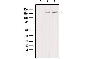 Western blot analysis of extracts from various samples, using MYOM2 Antibody. (MYOM2 anticorps  (Internal Region))