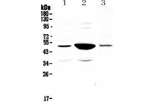 Western blot analysis of PAI1 using anti-PAI1 antibody . (PAI1 anticorps  (AA 24-240))