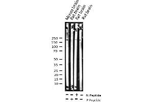 Western blot analysis of Phospho-IRS-1 (Ser312) expression in various lysates