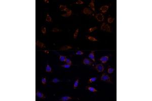 Immunofluorescence analysis of NIH-3T3 cells using MTCH2 Polyclonal Antibody  at dilution of 1:100 (40x lens).