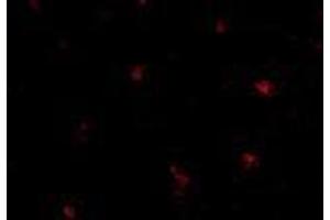 Immunofluorescence of human brain tissue using FEZ25 AP30334PU-N antibody at 5 μg/ml.