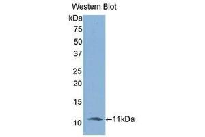 Western Blotting (WB) image for anti-Interleukin 6 Receptor (IL6R) (AA 19-108) antibody (ABIN3206013) (IL-6 Receptor anticorps  (AA 19-108))