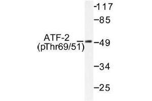 Image no. 1 for anti-Activating Transcription Factor 2 (ATF2) (pThr51), (pThr69) antibody (ABIN317965)