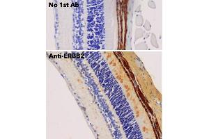 Immunohistochemistry (IHC) image for anti-Receptor tyrosine-protein kinase erbB-2 (ErbB2/Her2) (C-Term) antibody (ABIN6254225)