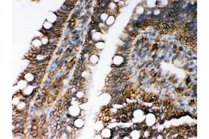 IHC testing of FFPE rat intestine with HLA-C antibody. (HLA-C anticorps)