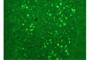 Immunostaining of rat cerebellum showing fluorescence of calretinin containing cells.