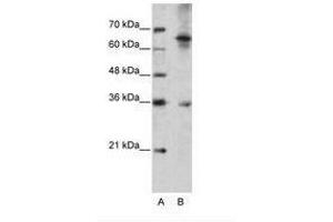 Image no. 2 for anti-Wingless-Type MMTV Integration Site Family, Member 9B (WNT9B) (AA 231-280) antibody (ABIN202335)