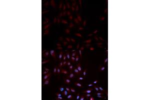 Immunofluorescence analysis of U2OS cells using Phospho-MAPK14-Y322 antibody (ABIN5969909).