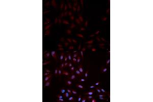 Immunofluorescence analysis of U2OS cells using Phospho-MAPK14-Y322 antibody (ABIN5969909). (MAPK14 anticorps  (pTyr322))