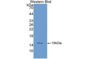 Western blot analysis of the recombinant protein. (HRAS anticorps  (AA 82-176))