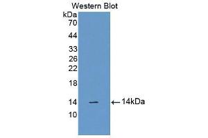 Western blot analysis of the recombinant protein. (CUBN anticorps  (AA 3511-3623))
