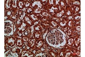 Immunohistochemical analysis of paraffin-embedded Human-kidney, antibody was diluted at 1:100 (EYA1 anticorps)