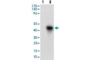 Western blot analysis of Lane 1: Negative control [HEK293 cell lysate]; Lane 2: Over-expression lysate [ROR2 (AA: 59-155)-hIgGFc transfected HEK293 cells] with ROR2 monoclonal antibody, clone 6F2D10  at 1:500-1:2000 dilution.
