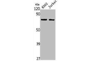 Western Blot analysis of K562 Jurkat cells using HGFA Polyclonal Antibody (HGFA anticorps  (C-Term))
