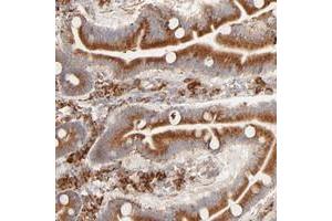 Immunohistochemical staining of human duodenum with PARP12 polyclonal antibody  shows strong cytoplasmic positivity in glandular cells. (PARP12 anticorps)