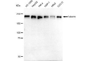 Western blotting analysis using Tuberin antibody (ABIN7800657). (Recombinant Tuberin anticorps)