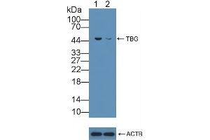 Knockout Varification: Lane 1: Wild-type Hela cell lysate, Lane 2: TBG knockout Hela cell lysate, Predicted MW: 46kd Observed MW: 46kd Primary Ab: 5 μg/mL Rabbit Anti-Human TBG Antibody Second Ab: 0.