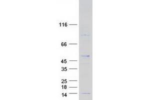 Validation with Western Blot