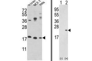 Image no. 1 for anti-Cofilin 1 (CFL1) (N-Term) antibody (ABIN452840) (Cofilin anticorps  (N-Term))