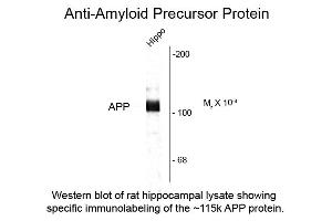 Western Blot of Anti-Beta Amyloid (Rabbit) Antibody - 612-401-253 Western Blot of Rabbit Anti-Beta Amyloid antibody.