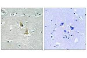 Immunohistochemistry analysis of paraffin-embedded human brain tissue using p47 phox (Ab-345) antibody.
