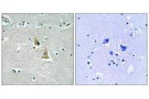 Immunohistochemistry analysis of paraffin-embedded human brain tissue using p47 phox (Ab-345) antibody. (NCF1 anticorps  (Ser345))
