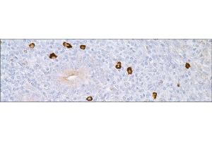 Image no. 1 for Rabbit anti-Human IgM (Chain mu) antibody (ABIN952869) (Lapin anti-Humain IgM (Chain mu) Anticorps)