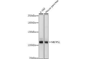 Western blot analysis of extracts of various cell lines, using MBTPS1 antibody (ABIN7268470) at 1:1000 dilution. (MBTPS1 anticorps  (AA 803-1052))