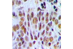 Immunohistochemistry (IHC) image for anti-SWI/SNF Related, Matrix Associated, Actin Dependent Regulator of Chromatin, Subfamily B, Member 1 (SMARCB1) antibody (ABIN7308350)