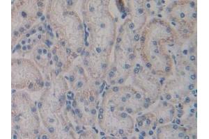 Detection of TLR4 in Rat Kidney Tissue using Polyclonal Antibody to Toll Like Receptor 4 (TLR4)