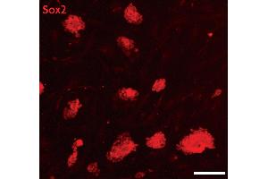 Sox2 antibody (pAb) tested by Immunofluorescence.