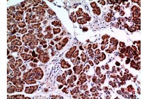 Immunohistochemistry (IHC) analysis of paraffin-embedded Human Pancreas, antibody was diluted at 1:100. (Amphiphysin anticorps  (C-Term))