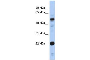 WB Suggested Anti-CSRP1 Antibody Titration:  0. (CSRP1 anticorps  (Middle Region))