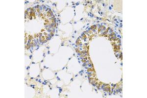 Immunohistochemistry of paraffin-embedded mouse lung using CEACAM5 antibody. (CEACAM5 anticorps)