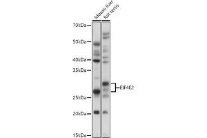 Western blot analysis of extracts of various cell lines, using EIF4E2 antibody (ABIN6130366, ABIN6140086, ABIN6140087 and ABIN6220578) at 1:1000 dilution. (EIF4E2 anticorps  (AA 1-240))