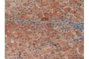 Detection of C1qA in Human Liver Tissue using Polyclonal Antibody to Complement Component 1, Q Subcomponent A (C1qA)