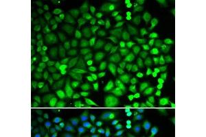 Immunofluorescence analysis of MCF-7 cells using PSMB2 Polyclonal Antibody