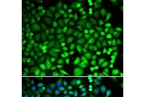Immunofluorescence analysis of MCF-7 cells using PSMB2 Polyclonal Antibody (PSMB2 anticorps)