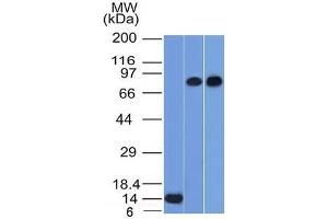 Western Blot of Recombinant, PC3 and HeLa cell lysates using p63 Mouse Monoclonal Antibody (TP63/1786). (p63 anticorps  (AA 3-106))