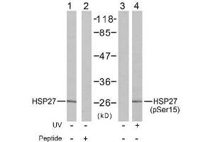 Image no. 2 for anti-Heat Shock 27kDa Protein 1 (HSPB1) (pSer15) antibody (ABIN196894) (HSP27 anticorps  (pSer15))